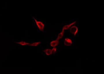ITGB3 / Integrin Beta 3 / CD61 Antibody