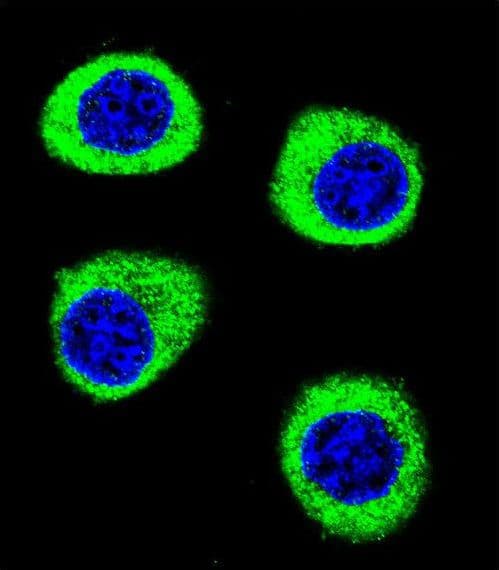 Polyclonal Rabbit anti-Human CPSF3L Antibody (aa91-119, IHC, IF, WB)
