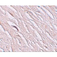 SLC39A2 / ZIP2 Antibody