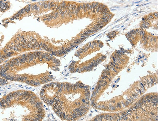 MDK / Midkine Antibody
