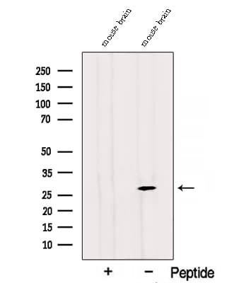 RAB3C Antibody