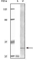 Monoclonal Mouse anti-Human BLK Antibody (clone 9D10B7, IHC, WB)