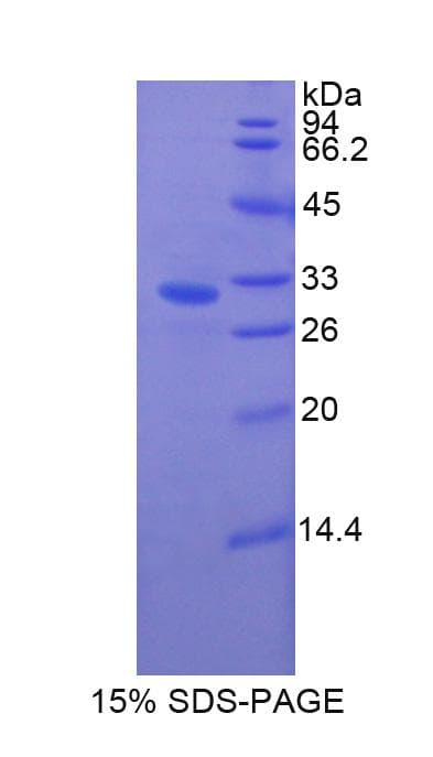 Bovine GSN / Gelsolin Protein (Recombinant His-T7)