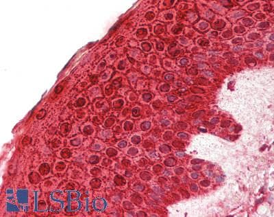 IHC-plus™ CALML5 Antibody (aa1-146)
