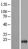 HSPC004 / POP5 Protein (Over-Expression Lysate Myc-DDK (Flag))