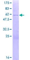 Human ZNF691 Protein (Recombinant GST)