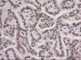 NOTCH1 Antibody (clone OTI4C9)