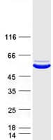 Human PSTPIP1 Protein (Recombinant Myc-DDK (Flag))