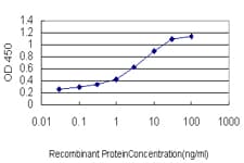 IHC-plus™ Monoclonal Mouse anti-Human AHCYL1 / DCAL Antibody (clone 5D6, IHC, WB)