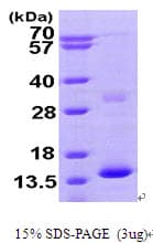 Human HBZ Protein (Recombinant His)