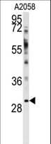 WBP2 Antibody (aa19-47)