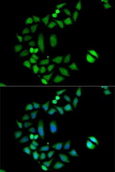 CLIC1 / NCC27 Antibody