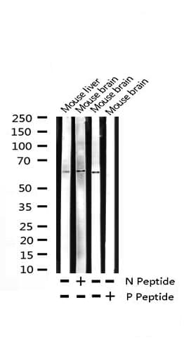 STK11 / LKB1 Antibody (phospho-Thr189)