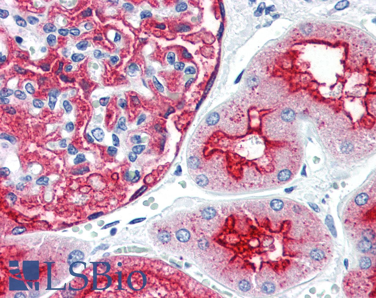IHC-plus™ Polyclonal Rabbit anti-Human MME / CD10 Antibody (clone E19-P, IHC)