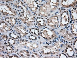 ERIC-1 / TACC3 Antibody (clone OTI7B11)