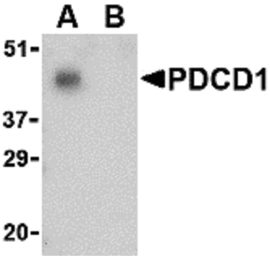 IHC-plus™ PDCD1 / CD279 / PD-1 Antibody