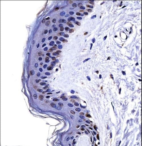 Polyclonal Rabbit anti-Human CSRP2 Antibody (aa68-96, IHC, WB)