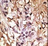 MAP1LC3B / LC3B Antibody (aa77-106)