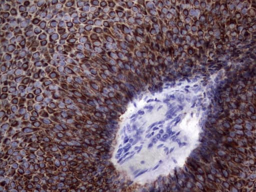 KRT19 / CK19 / Cytokeratin 19 Antibody (aa240-390, clone OTI7H7)