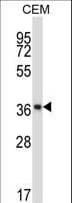 NFKBIB / IKB Beta / IKBB Antibody (aa326-355)