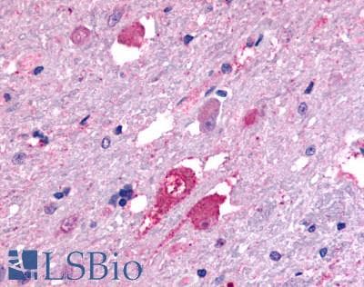 PathPlus™ Polyclonal Rabbit anti-Human GALR2 / Galanin Receptor 2 Antibody (Transmembrane Domain, IHC)