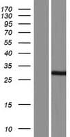 RNF212 Protein (Over-Expression Lysate Myc-DDK (Flag))
