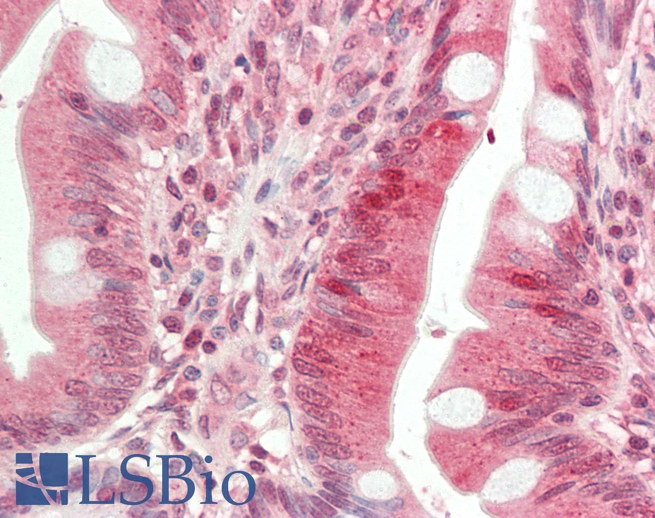 IHC-plus™ Polyclonal Rabbit anti-Human HDAC9 Antibody (Internal, IHC, WB)