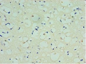 SPAG16 Antibody (aa1-183)