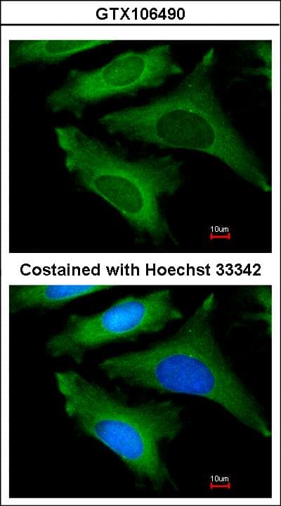 IL1RN Antibody (aa1-177)