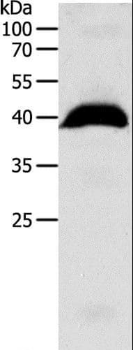 Polyclonal Rabbit anti-Human OPRL1 / ORL1 Antibody (WB)