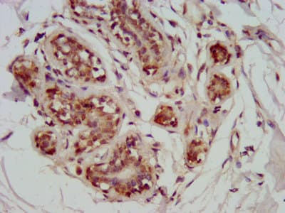 GATAD2A Antibody