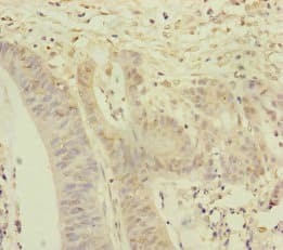 NAA25 Antibody