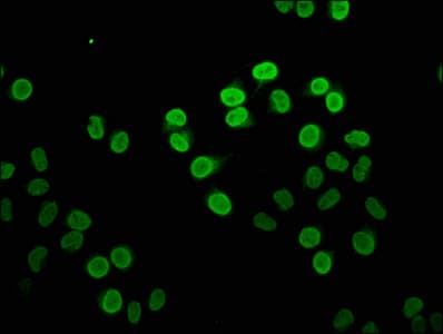 HIST1H4I Antibody