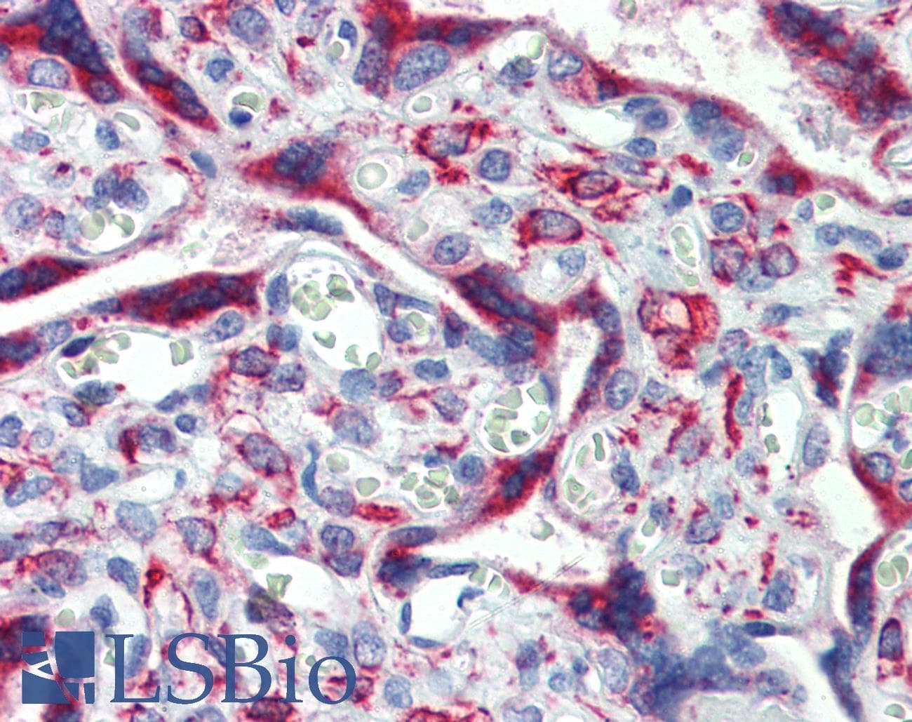 IGFBP4 Antibody (aa180-229)