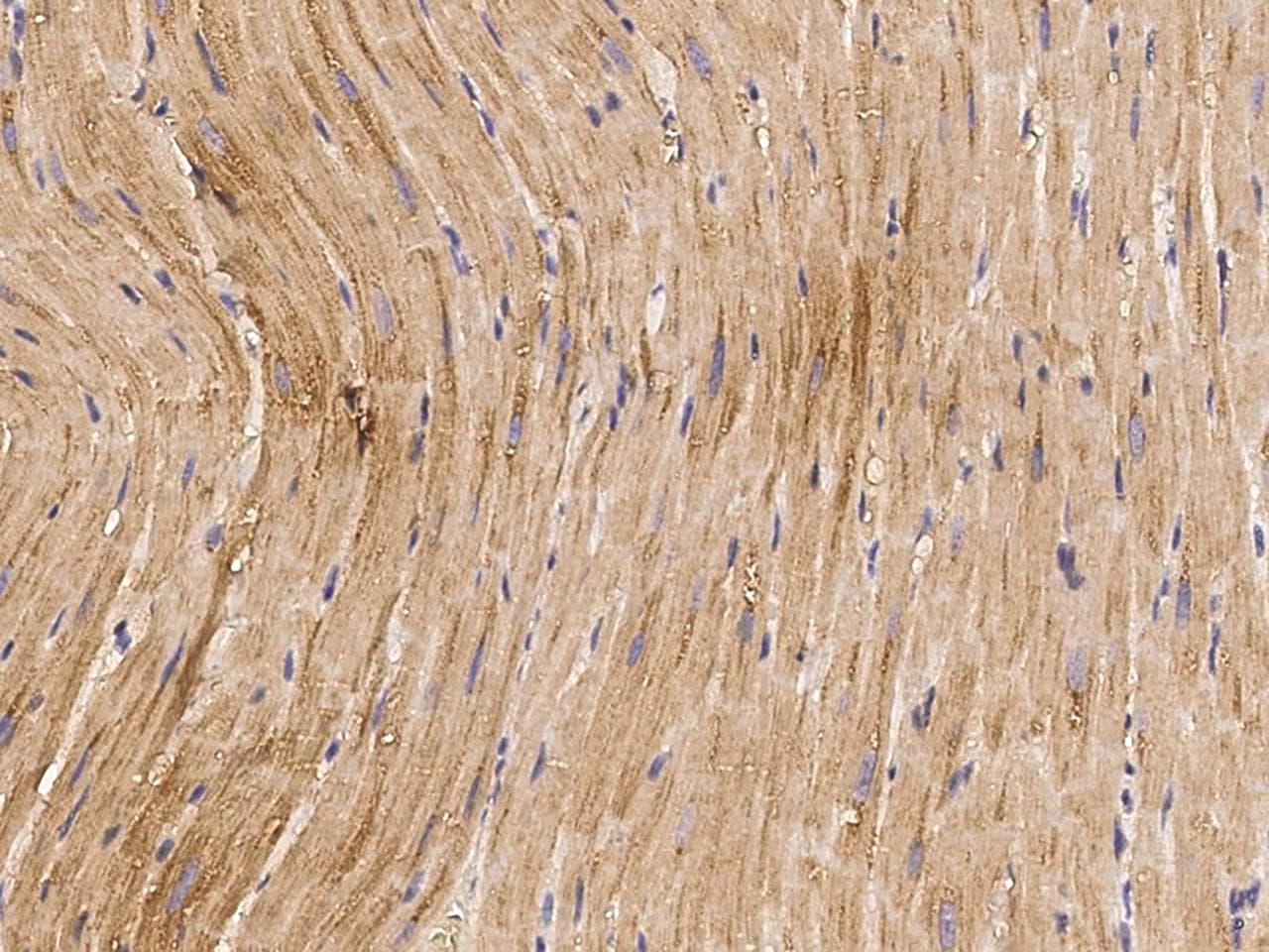 Monoclonal Mouse anti-Human VEGFA / VEGF Antibody (clone 02, Preservative Free, IHC)
