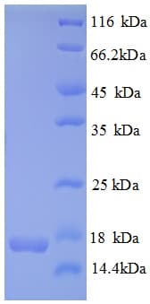 Human CDKN2AIPNL Protein (Recombinant His)