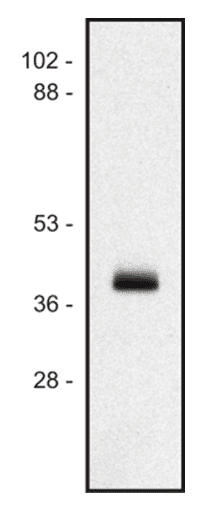 HLA-A/B/C Antibody (clone MEM-147)
