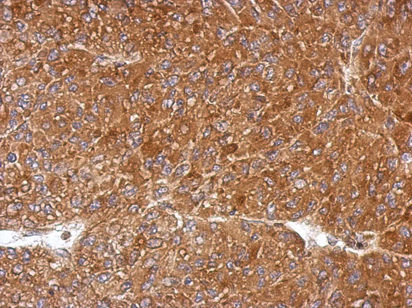 PGLS / 6PGL Antibody