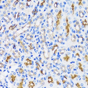Polyclonal Rabbit anti-Human MME / CD10 Antibody (IHC, WB)