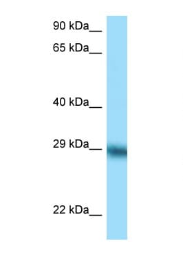 Polyclonal Rabbit anti-Human TFPI / LACI Antibody (C-Terminus, WB)