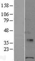 POLR1D Protein (Over-Expression Lysate Myc-DDK (Flag))
