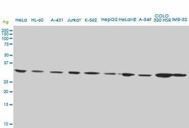 AIM / CD5L Antibody (clone 1C8)
