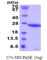 Human UBE2G1 Protein (Recombinant His)