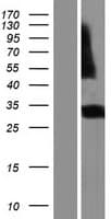 RGR Protein (Over-Expression Lysate Myc-DDK (Flag))