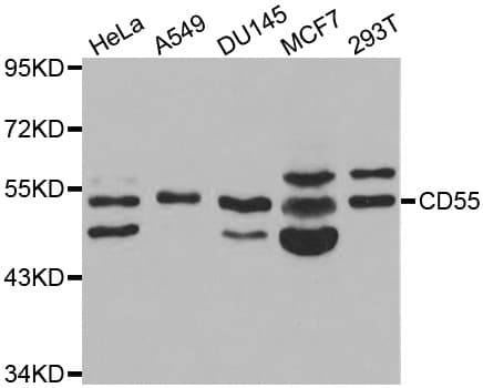 Polyclonal Rabbit anti-Human CD55 Antibody (IHC, IF, WB)