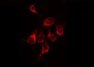 MMP11 Antibody