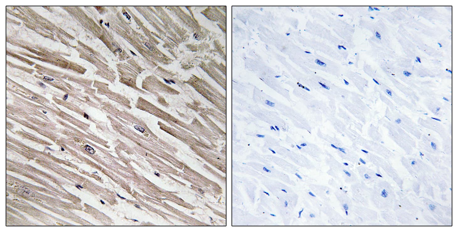 Polyclonal Rabbit anti-Human MRPL44 Antibody (aa221-270, IHC, IF, WB)