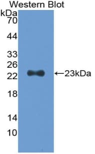 TNNI1 Antibody (aa1-187, APC)