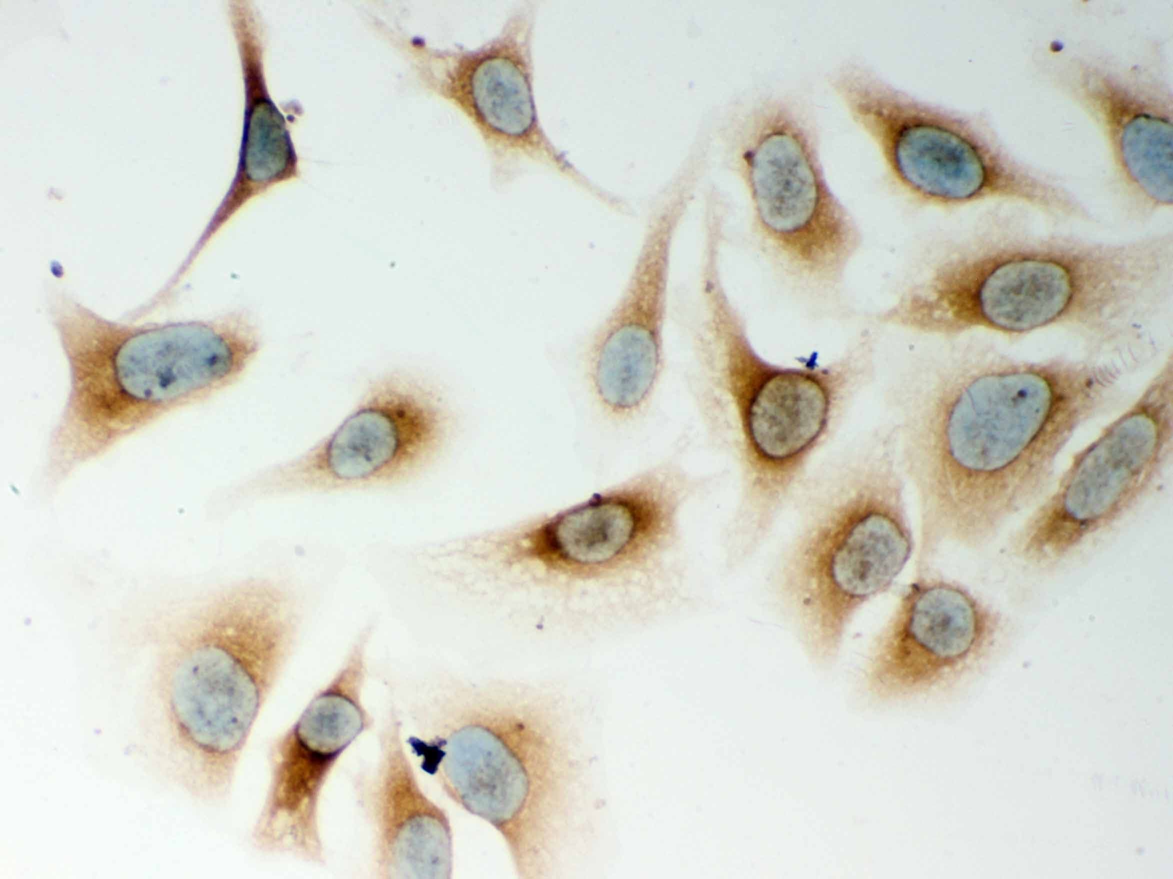 NOD1 Antibody (aa1-160)