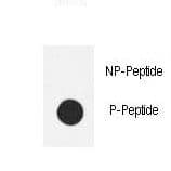 NOS3 / eNOS Antibody (phospho-Ser1177)